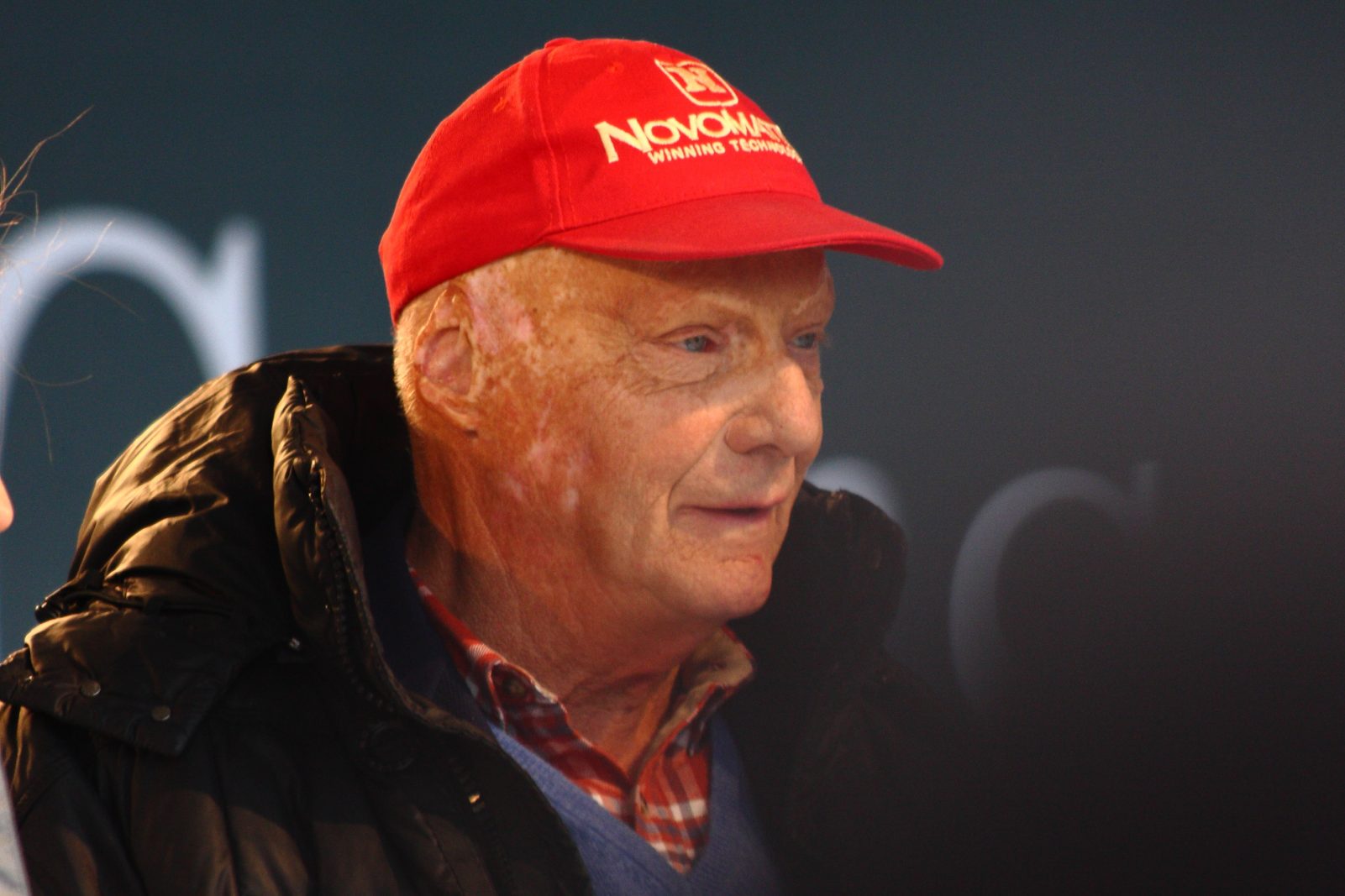 Niki Lauda burn